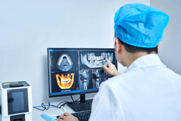 Best Emergency Wisdom Teeth Removal in Trafalgar, IN