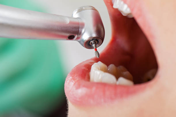Best Emergency Treatment for Dental Infections or Abscesses in Trafalgar, IN
